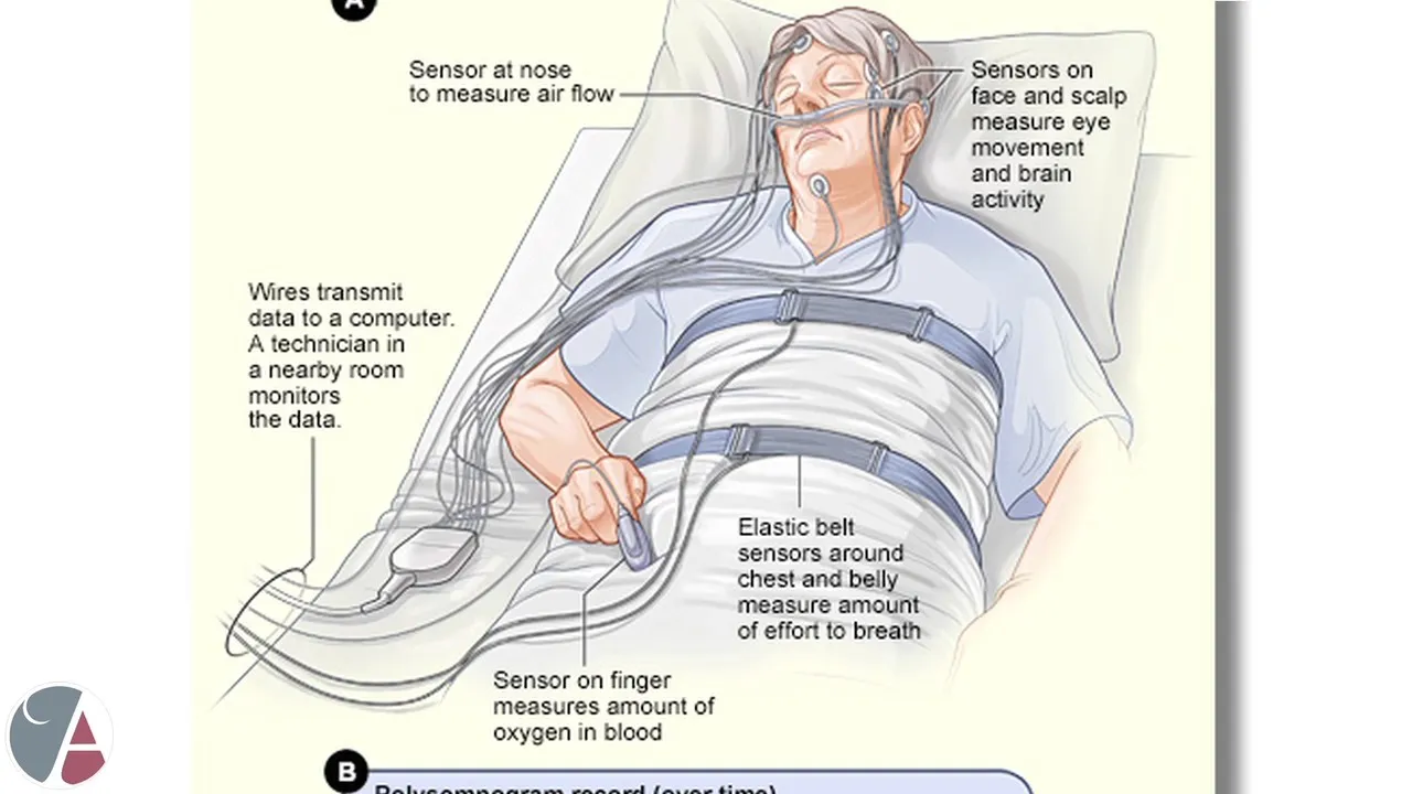 How Dentists Treat Sleep Apnea New Image Cosmetic & Family Dentistry Video Thumbnail