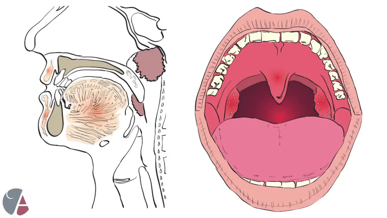 Snoring: Health Issues Associated with Snoring | New Image Cosmetic & Family Dentistry Video Thumbnail